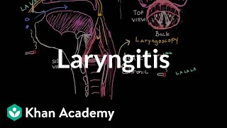 Laryngitis diagnosis treatment and prevention  NCLEXRN  Khan Academy [upl. by Sauveur]