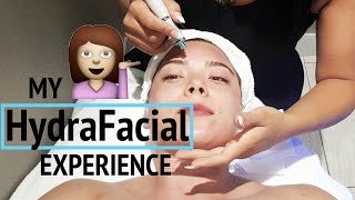 My HydraFacial Treatment  Watch The Before amp After [upl. by Nadda20]