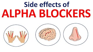 Alpha blocker side effects in easy way  Prazosin Terazosin Tamsulosin [upl. by Aloysius]