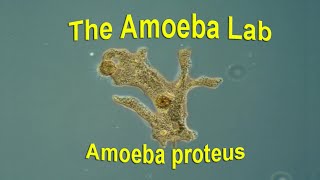 Amoeba Proteus – Time Lapse amp Real time by the Amoeba Lab [upl. by Eylrac]