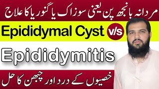 Epididymitis treatment in hindi  Epididymal cyst treatment  sozak Ka ilaj  Epididymitis [upl. by Ardnasac35]