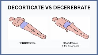 Decorticate vs Decerebrate Explained [upl. by Sterne577]