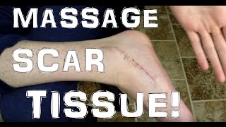 Muscle Scar Tissue Massage Why To Do It [upl. by Bron739]