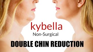 Kybella injection Double Chin Removal [upl. by Fidela289]