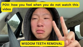 Wisdom Teeth Removal  Andis Vlogs [upl. by Eirahs]