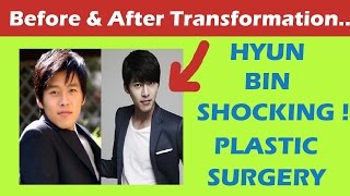 Hyun Bin Plastic Surgery Before and After Full HD [upl. by Ykcul694]