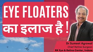 EYE FLOATERS का इलाज है  DO NOT LOSE HOPE  EYE FLOATERS को हटाया जा सकता है [upl. by Auroora]