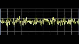 Detoxification General  Rife Frequencies [upl. by Lanie]