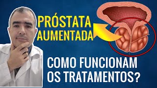 PRÓSTATA AUMENTADA como funcionam os tratamentos [upl. by Rouvin753]