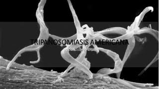 Tripanosomiasis americana BIOLOGÍA T cruzi resumen  memorización [upl. by Akemrehs446]