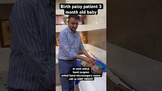 How to examine birth palsy patient 👏 vascularsurgery handsurgeon nerve [upl. by Neirual377]