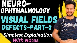 Visual Field Defect2Lesions Of Visual PathwayNEUROOPHTHALMOLOGY [upl. by Alaham673]