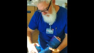 How to Apply amp Bivalve a Fiberglass Short Leg Cast [upl. by Lewin]