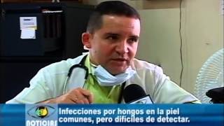 Infecciones por hongos en la piel comunes pero difíciles de detectar [upl. by Eaner643]