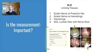 Integrative Diagnosis Sciatic nerve release using Manual Adhesion Release® a case study [upl. by Ahtiekahs]