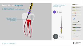 ProTaper Ultimate Endo File System  Shaping Sequence [upl. by Eninaej]