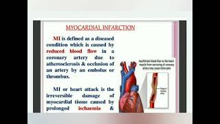 Myocardial Infarction  fully explained in Hindi  Examvila [upl. by Amlev]