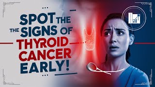 Thyroid Cancer Symptoms amp Early Warning Signs  Hypothyroidism  Thyroid  Cancer [upl. by Bainter]