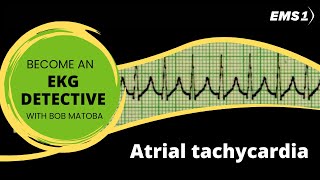 Atrial tachycardia  EKG Detective [upl. by Marek]