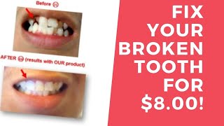 How I fixed my broken tooth for 8 Dollars [upl. by Donata]