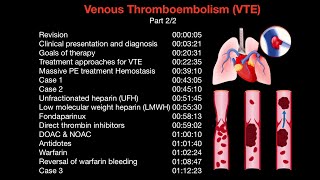 Pharmacotherapy of venous thromboembolism part22  Arabic [upl. by Ynnhoj940]