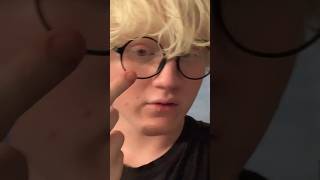 albeen albinismo albino albinism shorts youtubeshorts short viralvideo [upl. by Aseeral73]