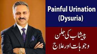 Painful Urination  Dysuria  Causes and Treatment [upl. by Jorgan]