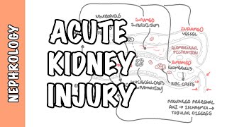 Acute Kidney Injury AKI  prerenal intrarenal and postrenal causes and pathophysiology [upl. by Adriel]