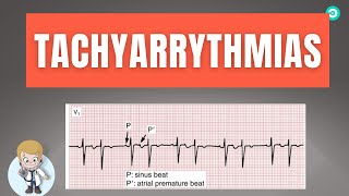 How to dignose Abnormal heart rhythm Tachyarrythmias On ECG  Step by step [upl. by Rosalba72]