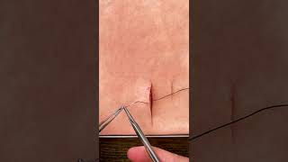 How to do a deep dermal suture 🪡 [upl. by Trish]