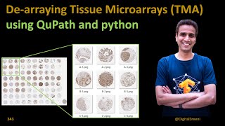 343 Dearraying Tissue Microarrays TMA using Qupath and python code [upl. by Theurich]