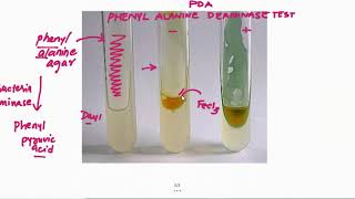 Phenylalanine agar deaminase PDA test 2 Minutes Microbiology Laboratory Methods Tutorials [upl. by Glanti]