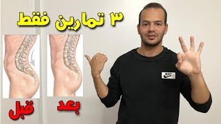 3 تمارين لحل مشكلة بروز المؤخرة [upl. by Vasyuta]