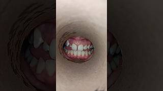 What Your SMILE Reveals About Your Oral Health 😃🦷 [upl. by Meris919]