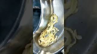 Tapeworm cestodes Surgical Removal In A Patient  Informative Video [upl. by Remle]