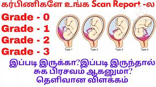 Placenta Grade 0placenta Grade 1 Grade 2Grade 3 என்றால் என்னPlacenta maturity grading in tamil [upl. by Runstadler]