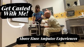 Above Knee Amputee Getting Casted for a Prosthetic Socket After Revision [upl. by Yankee489]