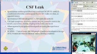 CSF Leak Rhinorrhea Sean Stanga MD [upl. by Emanuela645]