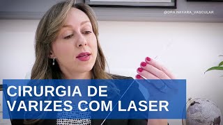 Cirurgia de varizes com LASER  Dra Nayara Cioffi Batagini  Cirurgiã Vascular e Endovascular [upl. by Linnie]