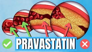 How to use Pravastatin Pravachol  Uses Side Effects Dosage  Doctor Explains [upl. by Jordison]