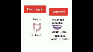 🕳 Peutz jegher Syndrome MNEMONIC 🕳 [upl. by Alessandra154]