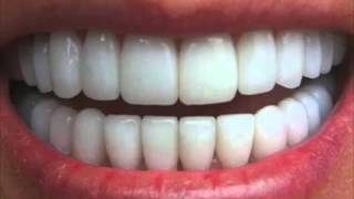 Get Perfectly Straight Teeth―∎ affirmations  Cure Overbite Underbite amp Crossbite [upl. by Hebbe]