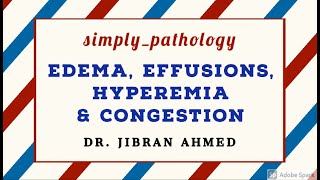 GENERAL PATHOLOGY II EDEMA EFFUSIONS HYPEREMIA CONGESTION II CHAP 4 II ROBBINS 10TH EDITION [upl. by Melonie34]