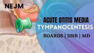 Tympanocentesis in Acute Otitis Media  NEJM Tutorial  DNB  MD  Boards [upl. by Adnilg265]