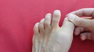 Big toe joint pain and problems explained [upl. by Ahseiyt]