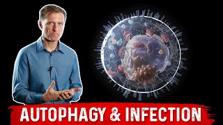 The Effects of Autophagy on Infection [upl. by Ern]