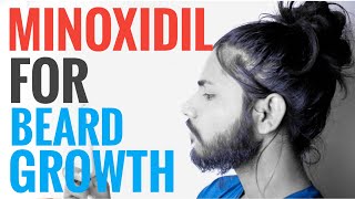 Should you use minoxidil for beard growth  Everything you need to know about minoxidil  INDIA [upl. by Lavinie]