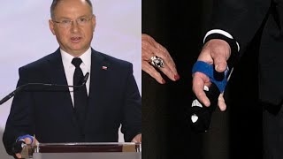 Andrzej Duda kontuzjowany Co na to lekarz quotNie był to mały urazquot [upl. by Amalbena828]