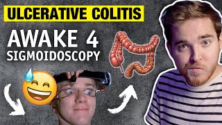 Sigmoidoscopy Story NO ANETHESIA  Ulcerative Colitis Diagnosis  My IBD Journey with UC [upl. by Anaytat]