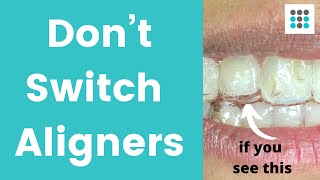 DON’T SWITCH ALIGNERS IF YOUR TEETH ARE NOT TRACKING l Dr Melissa Bailey Orthodontist [upl. by Kirchner]